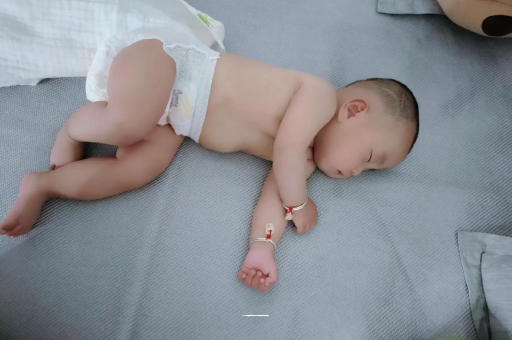 安康六个月宝宝眼睛散光